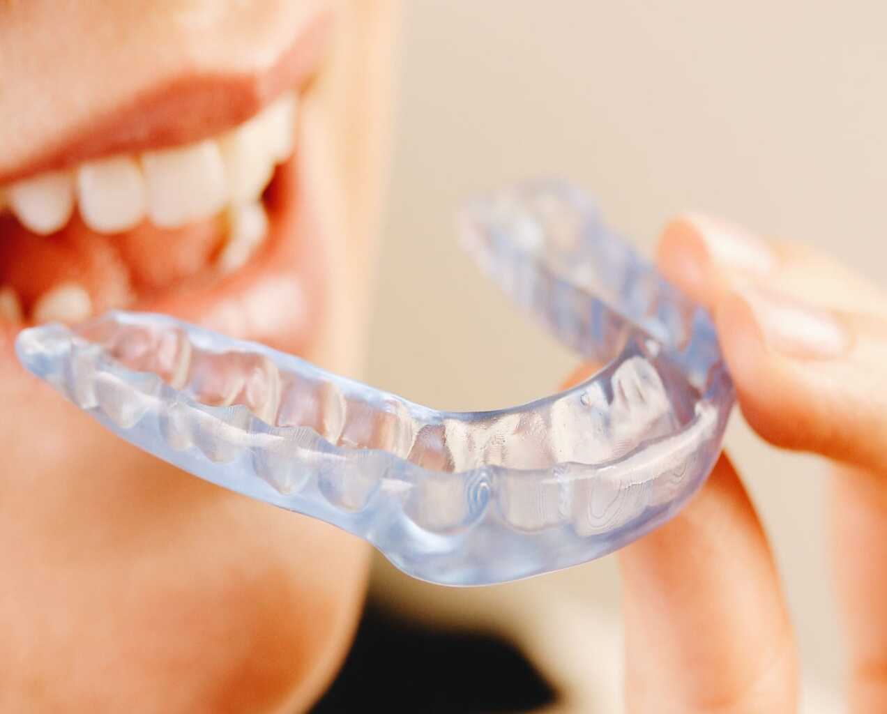 Primer plano de una persona sosteniendo una férula oclusal (placa de descarga) transparente de resina rígida entre sus dedos. Al fondo, se aprecian los dientes de la misma persona, indicando el uso del dispositivo para el tratamiento del bruxismo y la disfunción de la articulación temporomandibular (ATM).