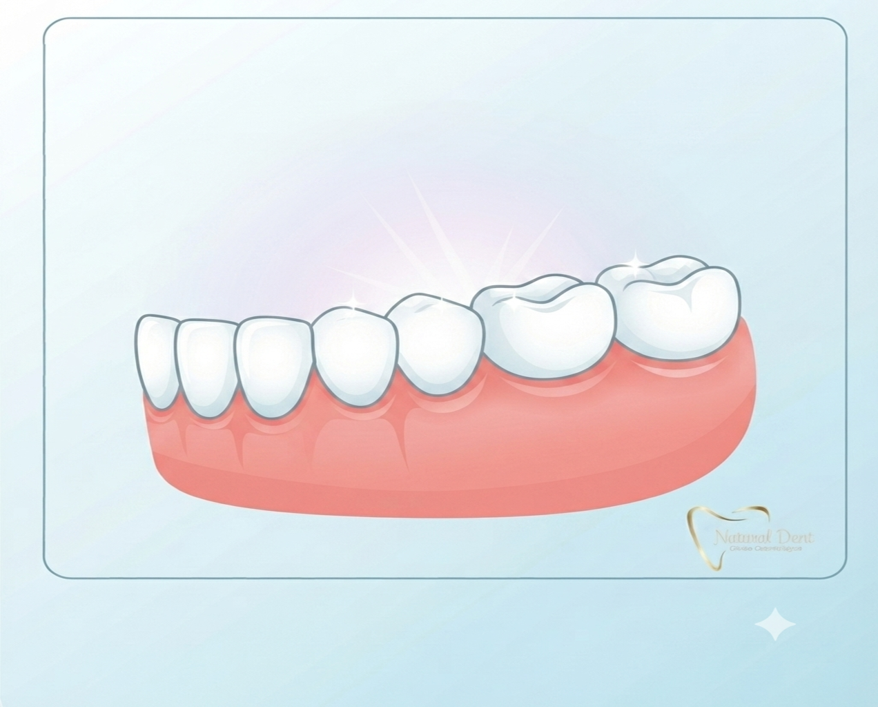 Ilustración didáctica para Natural Dent que muestra, de forma profesional y no explícita, una arcada dental perfectamente limpia, pulida y brillante, simbolizando una higiene dental profunda sin instrumentos ni sangre.