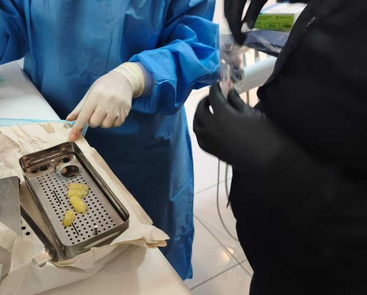 Dos profesionales de la salud en un entorno clínico manipulando muestras de plasma rico en plaquetas (PRP), mostrando membranas obtenidas en una bandeja quirúrgica metálica.