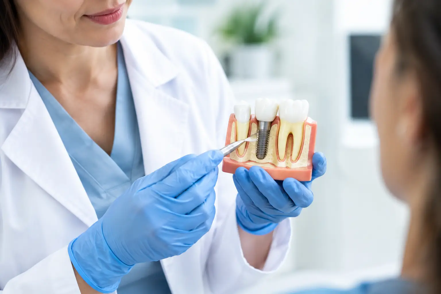 Cuándo hacer regeneración ósea dental antes de un implante